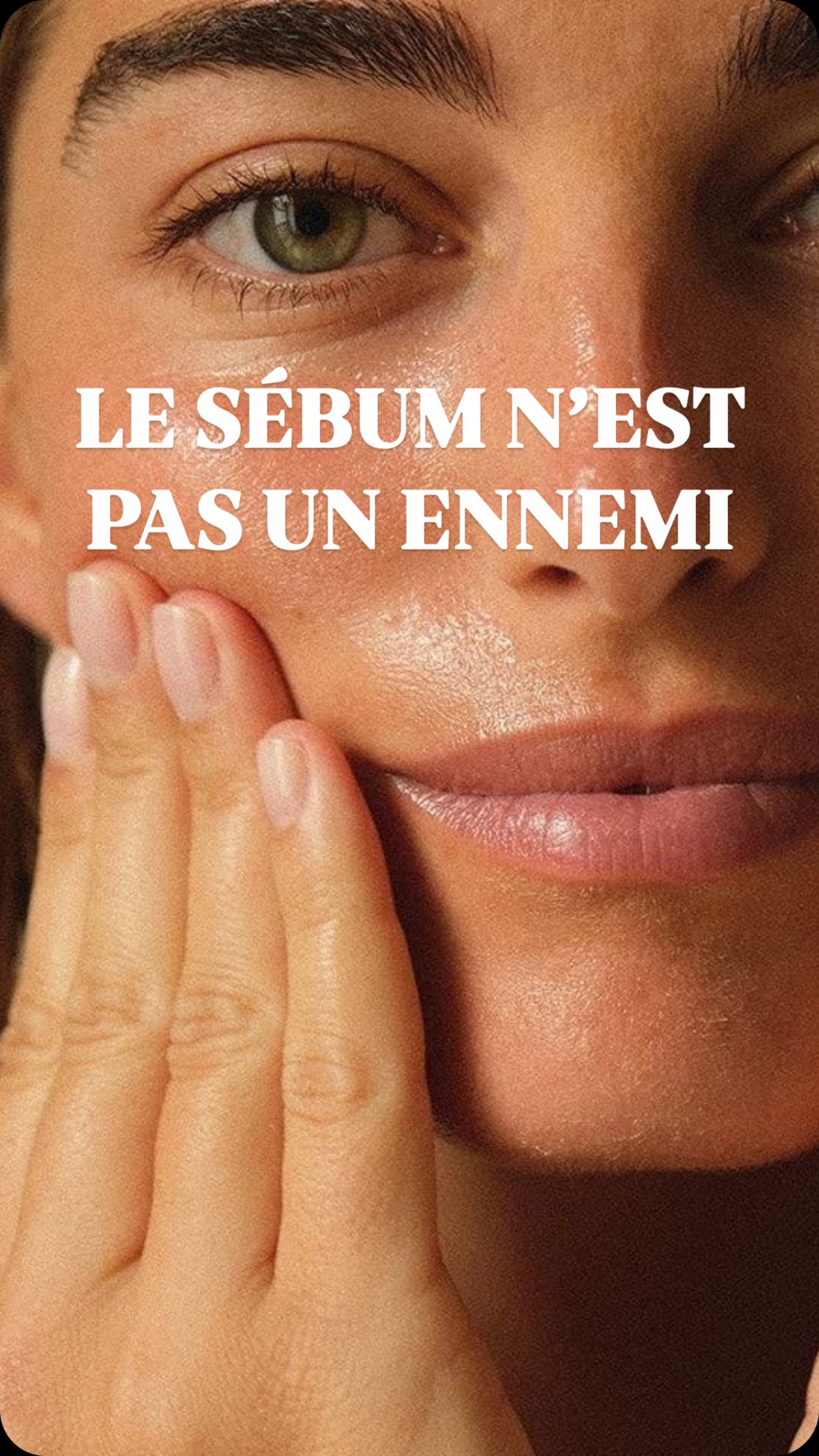 Les glandes sébacées sécrètent du sébum en éclatant les cellules sébacées matures, appelées sébocytes, dans le conduit folliculaire.
Le sébum n’est pas un ennemi. En revanche, si il y a une production excessive de sébum appelée « hyperséborrhée » c’est là que ça devient problématique.
Mais pourquoi cela arrive-t-il ?
Voici quelques raisons clés :
→ Les hormones mâles :
La testostérone, une hormone naturellement présente chez les femmes, peut être transformée en DHT (dihydrotestostérone). Cette conversion stimule les glandes sébacées, provoquant une augmentation de la production de sébum.
→ Carence en progestérone :
Une insuffisance en progestérone, surtout pendant la deuxième phase du cycle menstruel, peut favoriser la conversion de la testostérone en DHT. Résultat ? Encore un excès de sébum.
→ Le stress chronique : l’élévation excessive du cortisol, l’hormone du stress, occasionnera, encore, une augmentation de la production de testostérone.
→ Alimentation trop riche en sucre :
Les aliments à index glycémique élevé (comme le pain blanc, les produits transformés ou les féculents) ainsi que les produits laitiers qui sont riches en leucines peuvent entraîner une hypersécrétion de sébum. En augmentant l’insuline, ces aliments stimulent la production d’une hormone de croissance qui, à son tour, augmente les niveaux d’androgènes, qui eux-même stimulent la production de sébum par les glandes sébacées.
Et alors là grosse révélation, tu vas enfin avoir le déclic !
→ Lorsque les intestins sont débordés par l’élimination des toxines, et notamment que le foie n’arrive plus à gérer les graisses, la peau est employée pour prendre le relai et les glandes sébacées situés dans le derme prendront en charge les graisses.
On dit en naturopathie que les glandes sébacées sont comme 300 000 minis foies qui ont la même fonction que le foie que celui-ci est épuisé de travail.
Bon est-ce que c’est plus clair pour toi ?
J’ai essayé de vulgariser au maximum.
Sache qu’il est tout à fait possible de travailler dessus par ton hygiène de vie. Sollicite moi lors d’une consultation en naturopathie pour travailler sur la cause du problème.
#naturopathie #hormones #peaugrasse #acne