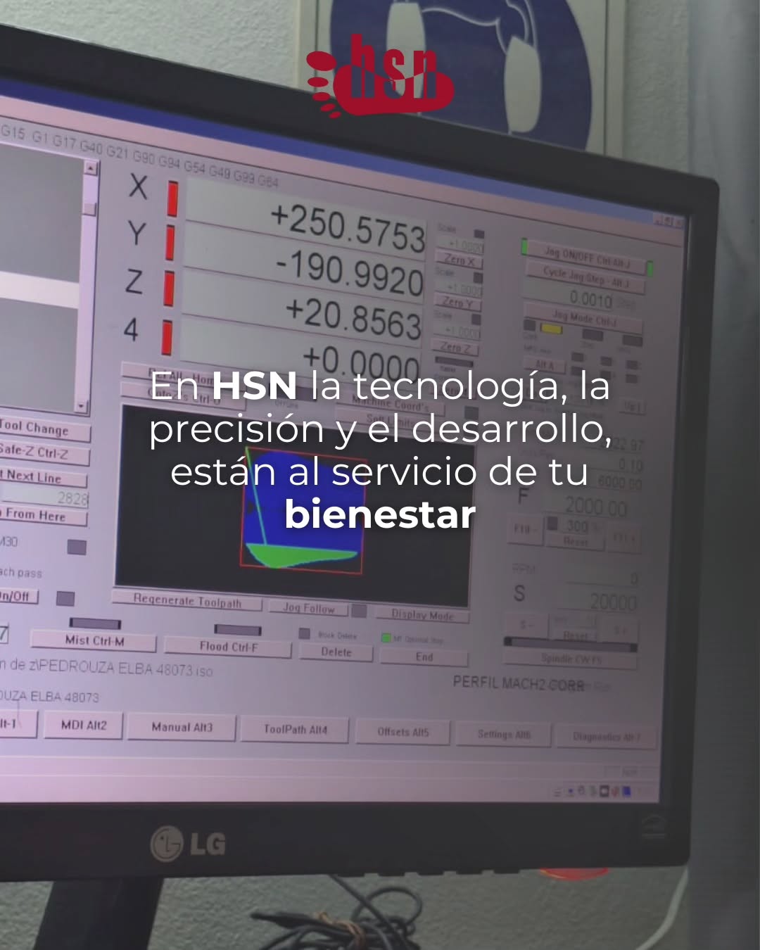 🦶📊 ¿Sabías cómo se analiza tu pisada? 📊🦶
En la ortopedia trabajamos con plataformas baropodométricas @sensormedica una tecnología que permite registrar cómo apoyás el pie al caminar o estar de pie 👣
El estudio es rápido, preciso y totalmente indoloro.
Con esa información diseñamos plantillas personalizadas, adaptadas a tu pisada, tu cuerpo y tus necesidades 💙
Porque no todos caminamos igual… y tus pies lo saben.
#Ortopedia #Baropodometría #SensorMedical #EstudioDePisada #PlantillasPersonalizadas SaludPostural CuidadoDeLosPies 👣🩺